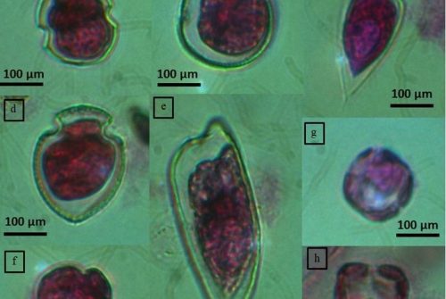 Effects of environmental variability on phytoplankton structure, diversity and biomass at the Brazil-Malvinas Confluence (BMC)