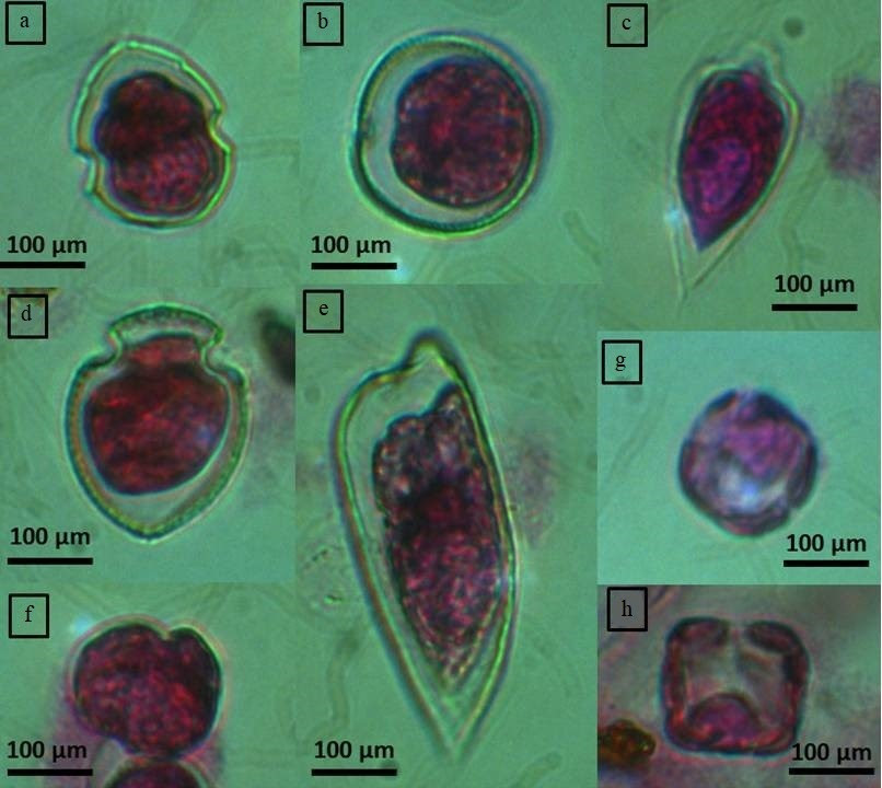 Effects of environmental variability on phytoplankton structure, diversity and biomass at the Brazil-Malvinas Confluence (BMC)