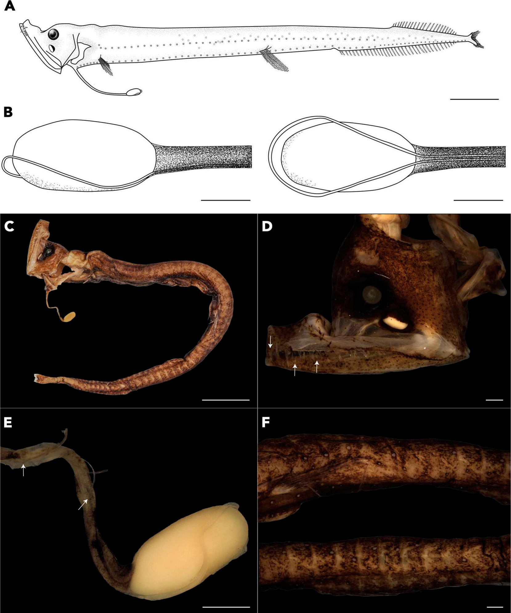 A New Species of Eustomias (Stomiiformes: Stomiidae) from the Western Tropical Atlantic, with Further Descriptions of E. braueri Zugmayer, 1911 and E. macrurus Regan and Trewavas, 1930